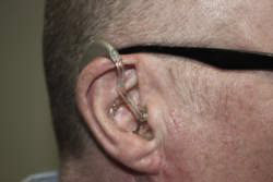 Hearing aid draping over the ear.